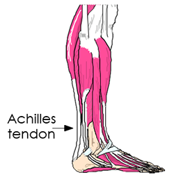 achilles tendon
